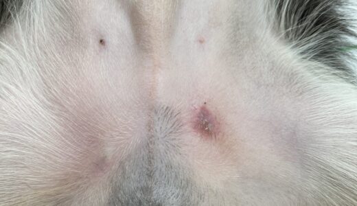 縫合糸反応性肉芽腫