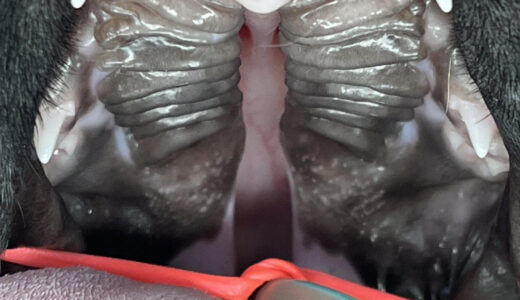 口蓋裂の治療について